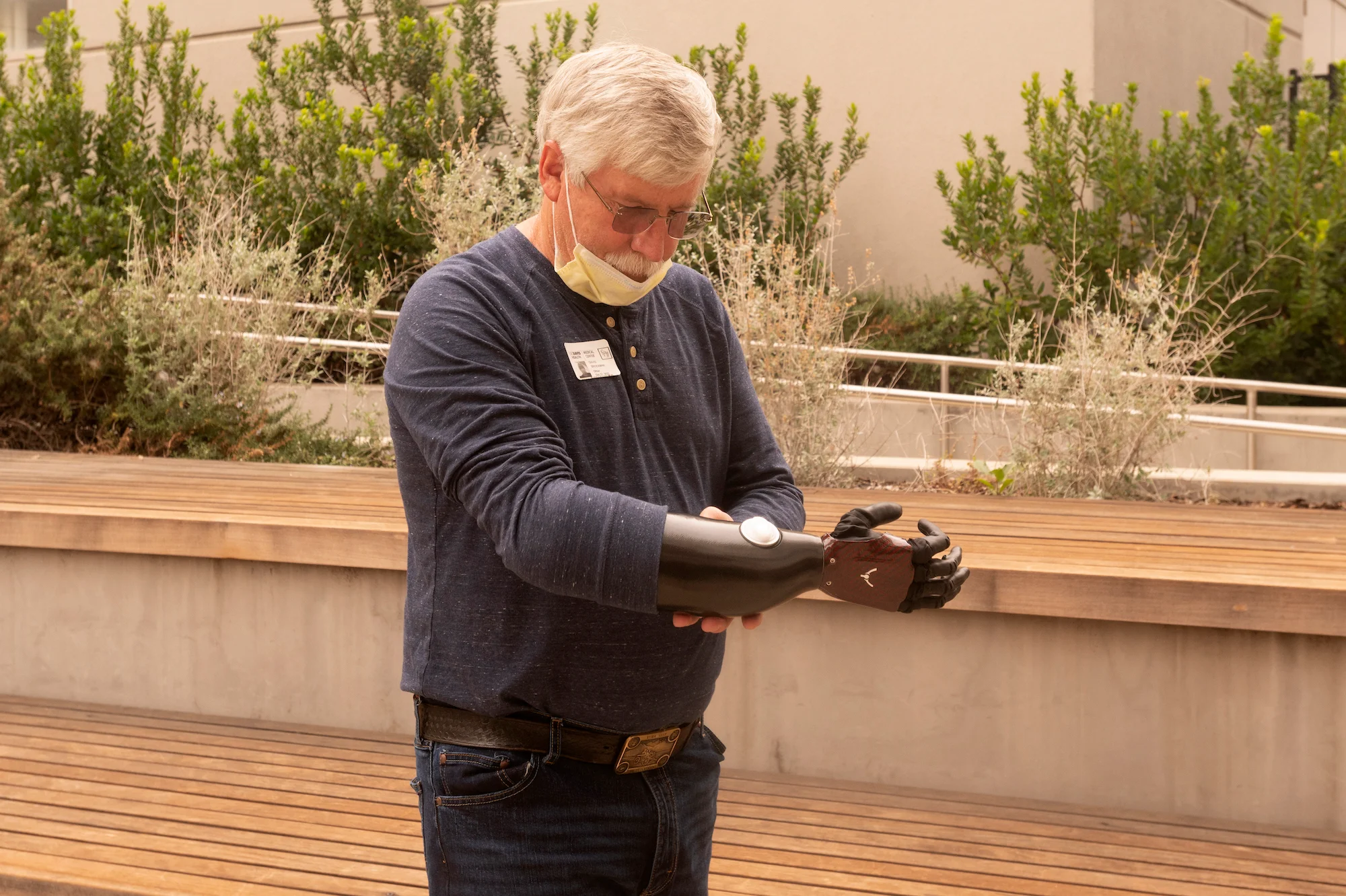 David Brockman, a retired firefighter and hand amputee, shows off his new myoelectric prosthetic device